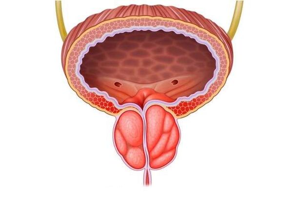 prostatīta ārstēšana vīriešiem